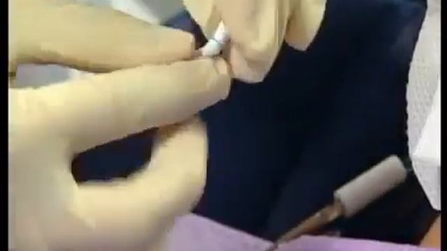 Отбеливание зубов ZOOM