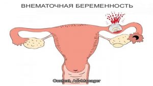 Эмбрион четко не визуализируется или не лоцируется: что это значит, почему на 5–6 неделе беременно.