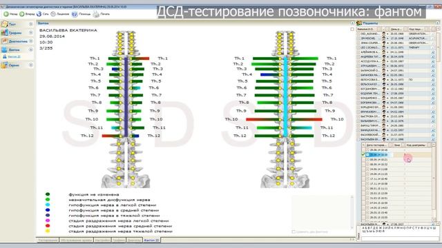 ПО "POINTS": интерпретация тестирования позвоночника смотреть онлайн