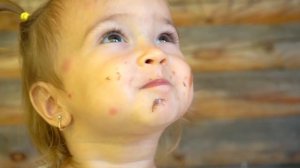 Мия и и весёлая история про огромный прыщ. Mia lol like бэбибон