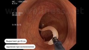 Наглядно, как работает биорезонанс