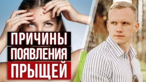 Почему появляются прыщи? / Питание против акне!