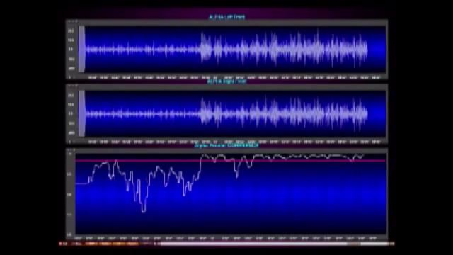ЭЭГ во время ТМ смотреть онлайн