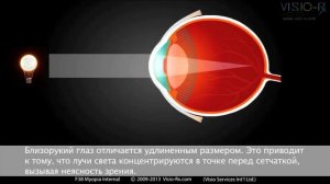 Миопия/близорукость (внутреннее). Как очки помогают скорректировать зрение.