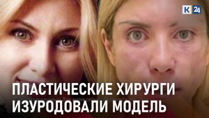 Модель лишилась мимики после пластической операции в краснодарской клинике