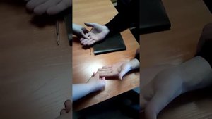 Жгут Эсмарха, правила наложения на плечо.