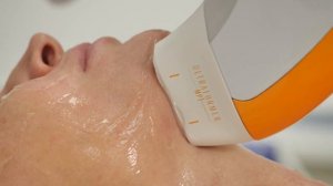 Ультраформер 4. Процедура Ультраформер лица в А Клинике