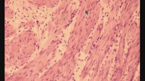 МОЧЕТОЧНИК  гистологическое строение  URETER