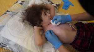 Правила ухода за центральным венозным катетером в домашних и стационарных условиях