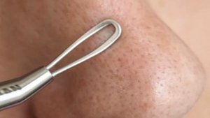 Как очистить поры на лице.Как очистить поры лица