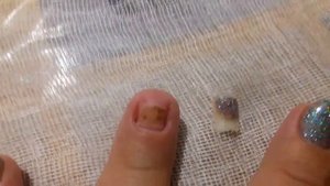 ААА! Очень БОЛЬНО! Сорвала нарощенный ноготь с корнем! Удаление ногтя. Remove nail yourself
