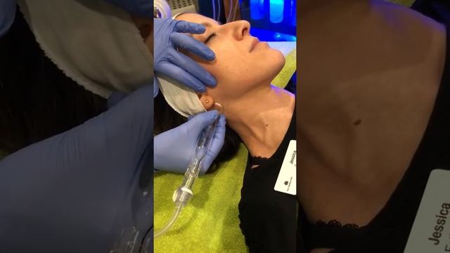 Lymphatic drainage with the Hydrafacial