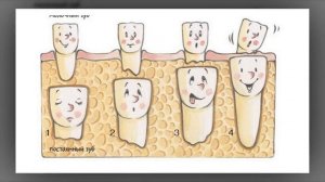 Почему меняются зубы? Рассказываем детям про зубы.