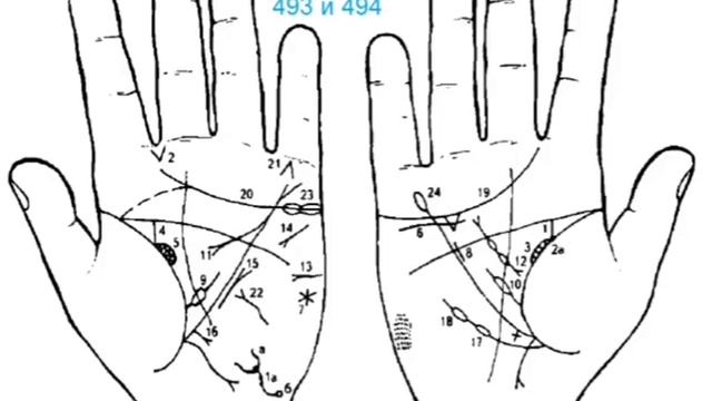 24. Стояновский Д.Н. Диагностика заболеваний по кожным рисункам ладони смотреть онлайн
