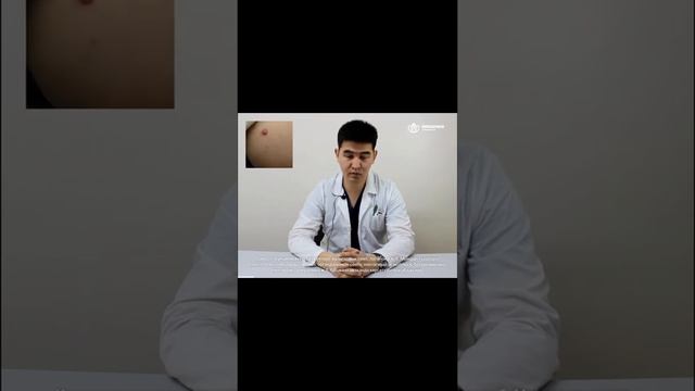 Криодеструкция