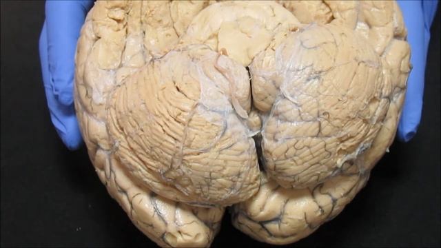 Задний мозг смотреть онлайн