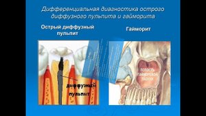 Лекция №2 для студентов 3 курса 6 семестра стоматологического факультета, французский