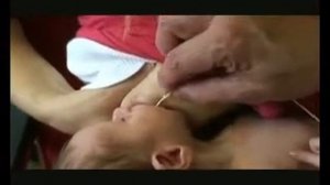 Dr. Jack Newman - Inserting a Lactation Aid