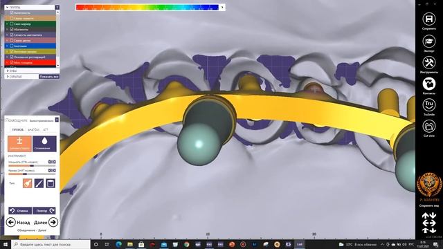 Моделировка первичной балки и каркаса в Exocad смотреть онлайн