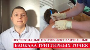 Лечение боли в спине НПВС Блокада триггерных точек Trigger Point Injection