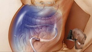 Пырей  лекарство у вас под ногами  Трава пырей целебные свойства, о которых мало кто знает 34 самых