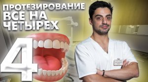 Какие показания к тотальному протезированию "все на четырех" или "все на шести"?