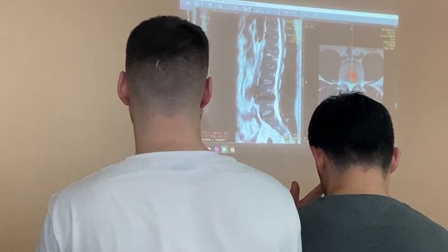 Доктор Епифанов. Грыжа поясничного отдела L4-L5. Осмотр МРТ, тестирования, способы лечения смотреть онлайн