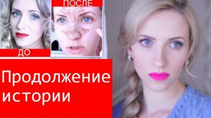 КОНЕЦ ИСТОРИИ или КАК ВЫБРАТЬ КОСМЕТОЛОГА