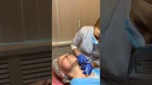 Биоревитализация Мезовартон