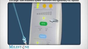 CompuDent STA Компьютерная анестезия | Обзор