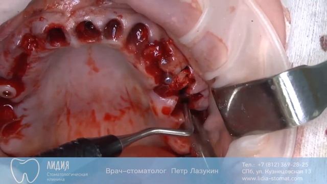 Один под углом смотреть онлайн