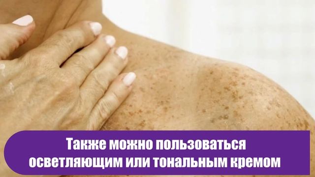 Темные пятна на руках пожилых людей: откуда появляются и что они значат