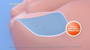 Лоцерил - подарите свободу ногам!