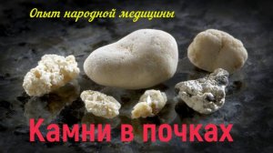 Камни в почках. Как избавится..