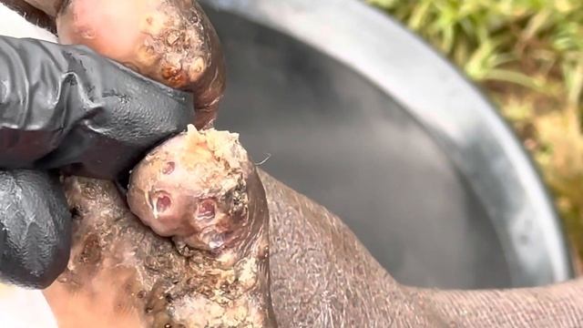 Moses's heavily jiggered left foot (part A) - watch FULL VIDEO @riseupsociety.net смотреть онлайн