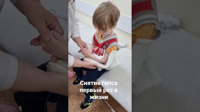 Снятие гипса первый раз в жизни