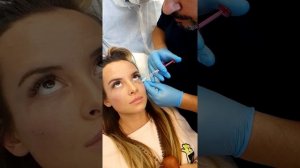 Что лучше для заполнения носослезных борозд: игла или канюля? Сравнение двух техник.