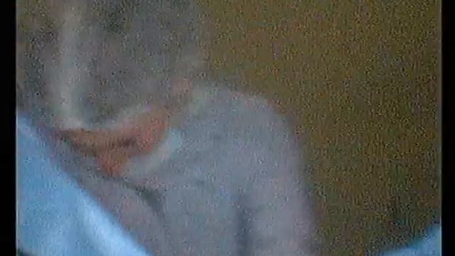 ფიბრომატოზი. фиброматоз