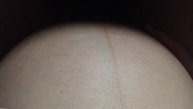 Беременность двойней - twins pregnancy - die Zwillingsschwangerschaft смотреть онлайн