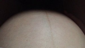 Беременность двойней - twins pregnancy -  die Zwillingsschwangerschaft