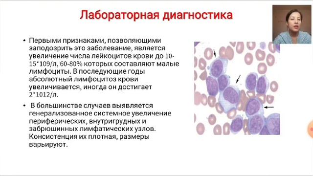 ЛАБОРАТОРНАЯ ДИАГНОСТИКА ХРОНИЧЕСКИХ ЛЕЙКОЗОВ смотреть онлайн
