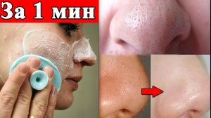 Простейший способ убрать Черные точки за 1 мин - Эффект сразу
