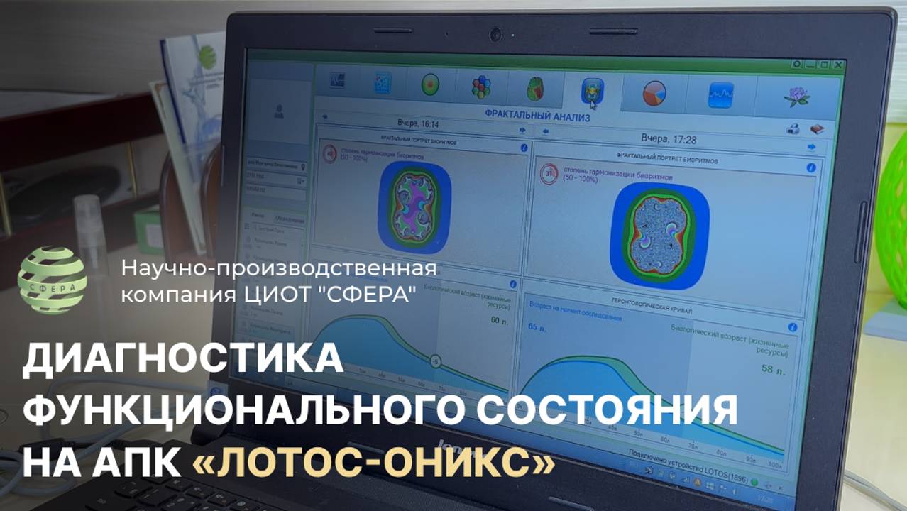 Диагностика функционального состояния на АПК "Лотос-Оникс". ЦИОТ  "Сфера"