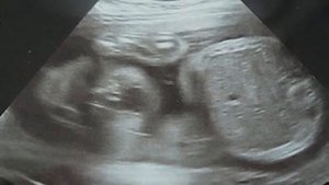 В Таком Возрасте - и Уже Родители! Не Рано ли?