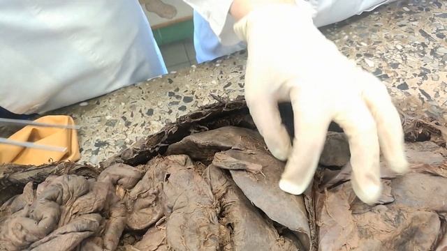 Анатомия | Пищеварительная система