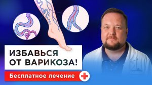 Как вылечить варикоз: народное лечение, лекарства или операция? Флеболог о варикозном расширении вен