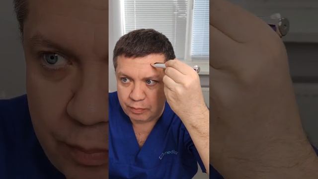 Почему опускаются брови при уколах ботокса в лоб? смотреть онлайн