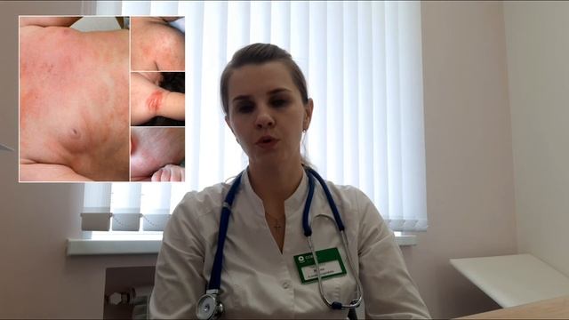 Потничка у новорожденных?Виды и причины! смотреть онлайн