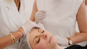 Рекомендации после коррекции Radiesse