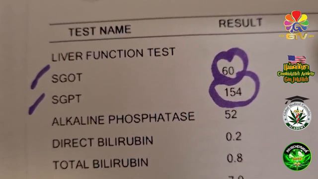 [F2691] แม่มดแนะนำการปรับปรุงยาโรคตับ โชว์ผลตรวจตับบอสอ๋องดีขึ้นแล้ว смотреть онлайн